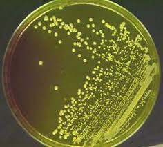 PREVALENCE AND ANTIMICROBIAL SUSCEPTIBILITY OF STAPHYLOCOCCUS AUREUS ISOLATED FROM CATTLE, BUFFALO, SHEEP AND GOAT`S RAWS MILK IN SOHAG GOVERNORATE, EGYPT.